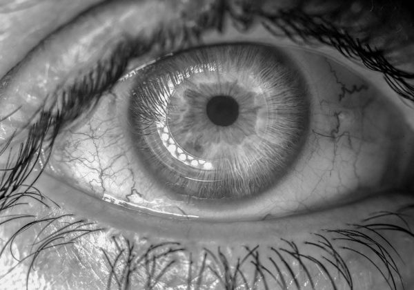 عوارض لنز رنگی در چشم